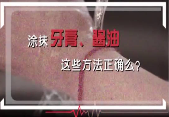 家庭烫伤如何处理